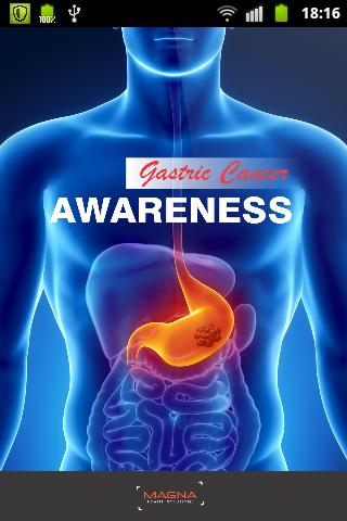 Gastric Cancer