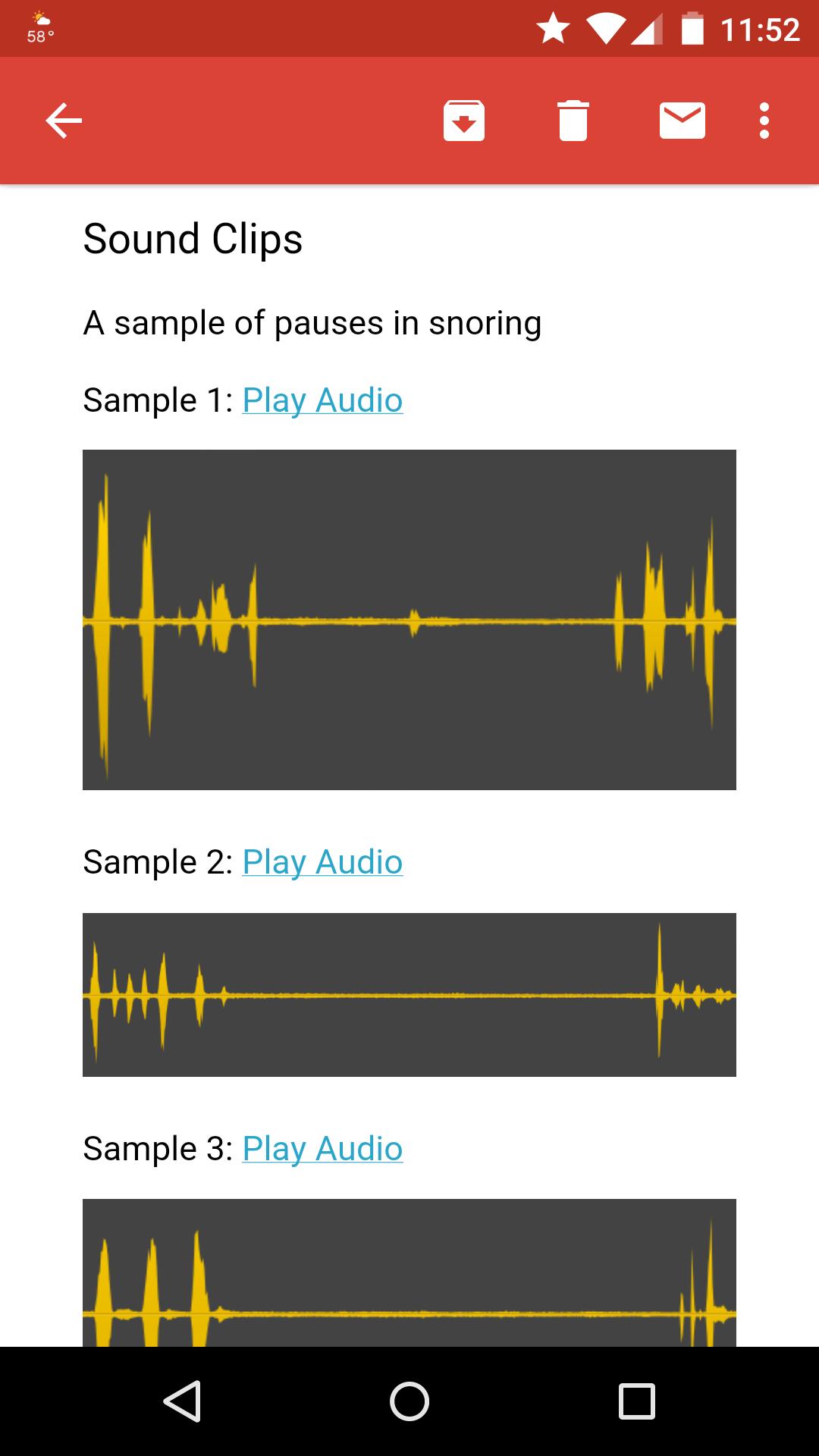 Snoring Analyzer