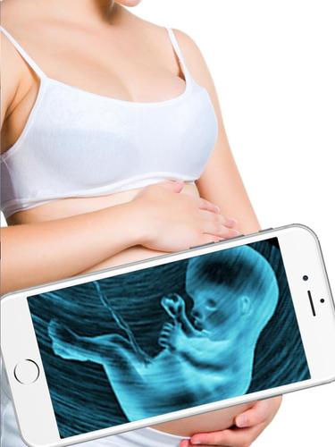 Ultrasound Scanner Sonography